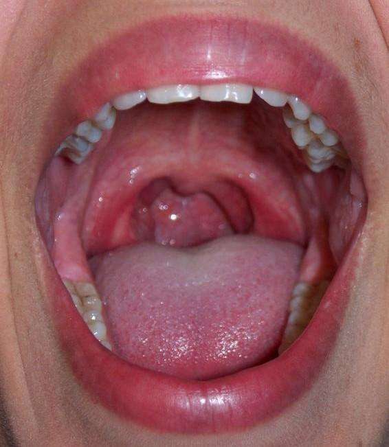 Human Male Mouth